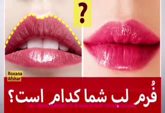 ١٠ شكل از فرم لب كه شخصيتتان را لو مى دهد!