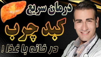 درمان کبد چرب در خانه بدون دارو