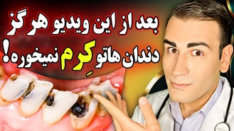درگیر پوسیدگی و کرم خوردگی دندان نخواهید شد!