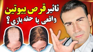 آیا مصرف قرص بیوتین از ریزش مو جلوگیری میکنه ؟!