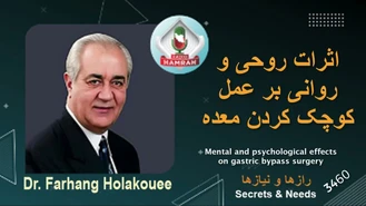 دکتر هلاکویی / اثر روحی و روانی بر عمل کوچک کردن معده Psychological effect on stomach shrinking