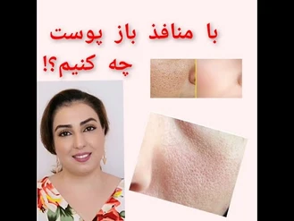 آموزش آرایش / روش هایی برای کوچک کردن منافذ پوست