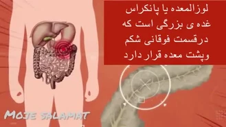 8 علائم در بدن که می گوید پانکراس یا لوزالمعده در حال تخریب است/نشانه های سرطان پانکراس