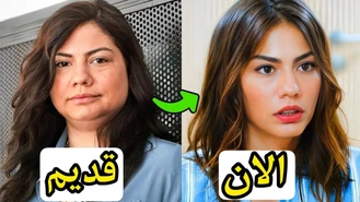 تغییرات شوکه کننده معروف ترین بازیگران زن ترکیه